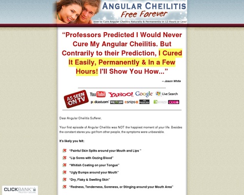 Angular Cheilitis Free Forever - How to Cure Angular Cheilitis Naturally & Permanently in 12 Hours or Less